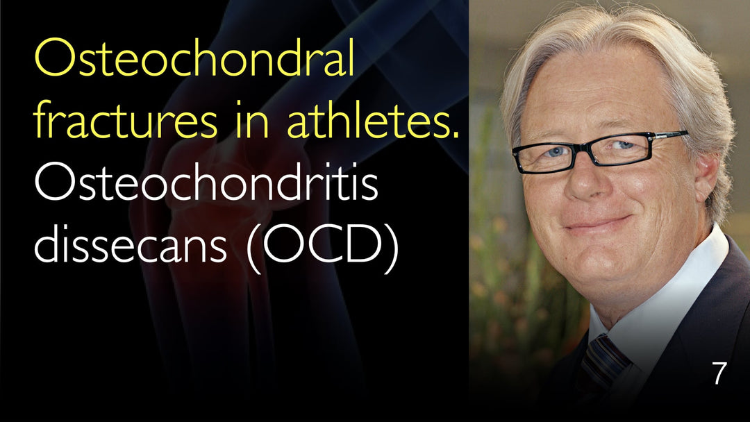 スポーツ選手に多い骨軟骨骨折と離断性骨軟骨炎(OCD)